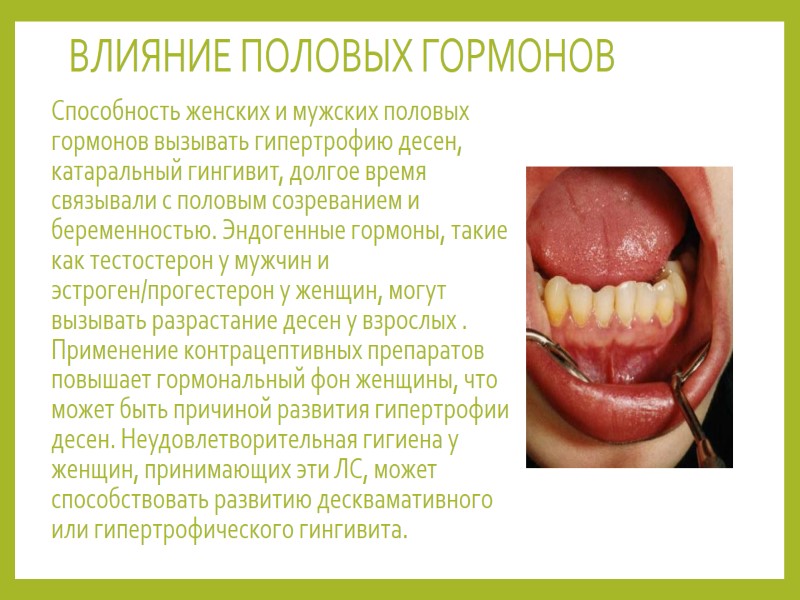 ВЛИЯНИЕ ПОЛОВЫХ ГОРМОНОВ  Способность женских и мужских половых гормонов вызывать гипертрофию десен, катаральный